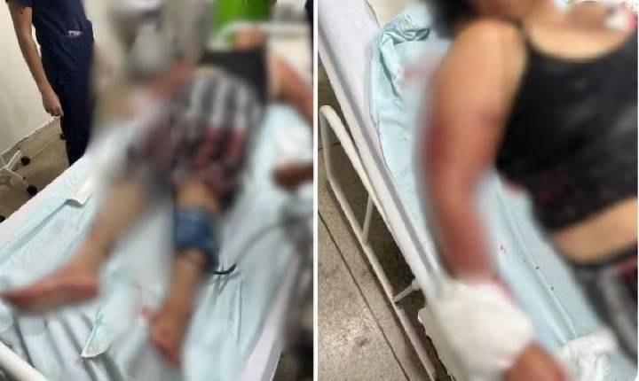 Avó atacada por pit bull isolou neta bebê em quarto e precisou trancar porta da casa para se livrar de mordidas do cão,
