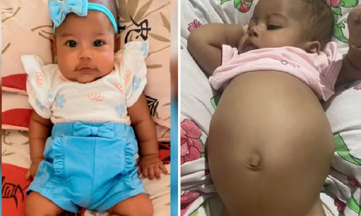 Bebê goiana de 4 meses com suspeita de tumor na barriga luta por tratamento na rede pública