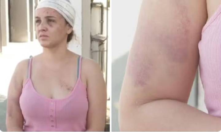 Cantora que denuncia ter sido espancada por parceiro de dupla diz que levou soco na frente dos filhos
