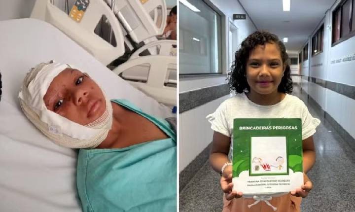 Criança que sofreu queimadura no rosto durante brincadeira supera trauma e escreve livro: ‘Dias de muita luta’