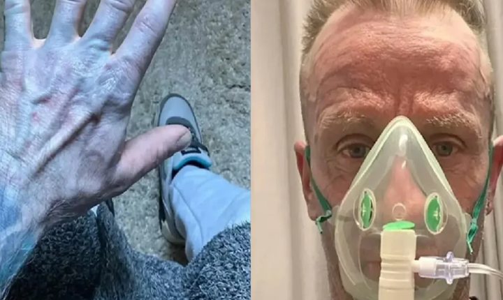 Homem acorda com o corpo azul, corre para o hospital e se choca com diagnóstico