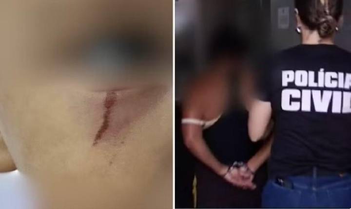 Irmão de criança de 3 anos espancada pela mãe por perder escova de cabelo também foi ferido durante agressão, diz delega