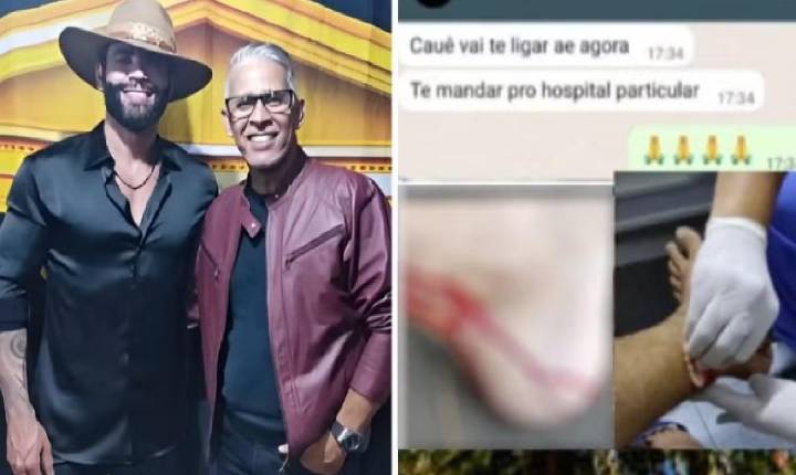 Irmão de Gusttavo Lima conta que foi mordido e derrubado por macaco enquanto passeava em parque, em Goiânia