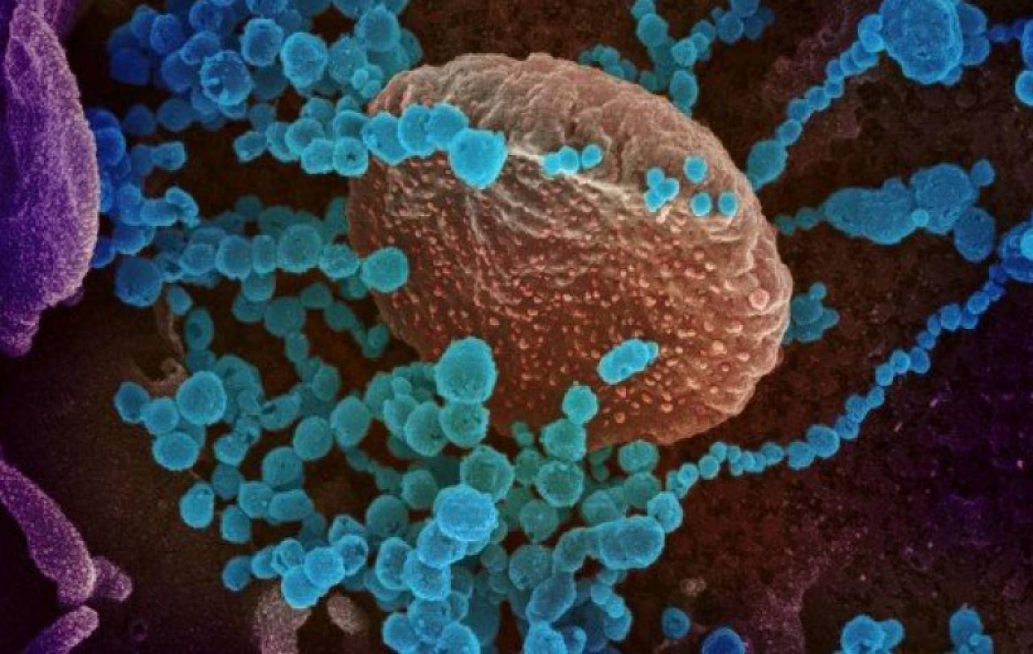 Novo tratamento experimental contra a Covid-19 reduz carga viral em 99,9% em testes com animais