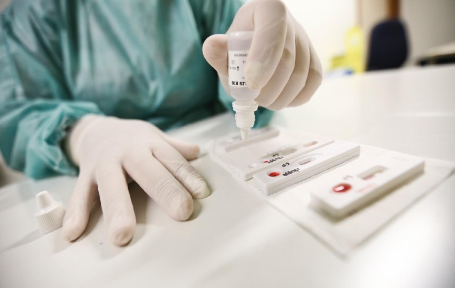 Mulher com HIV pode ter sido “curada” da infecção sem tratamento, dizem médicos