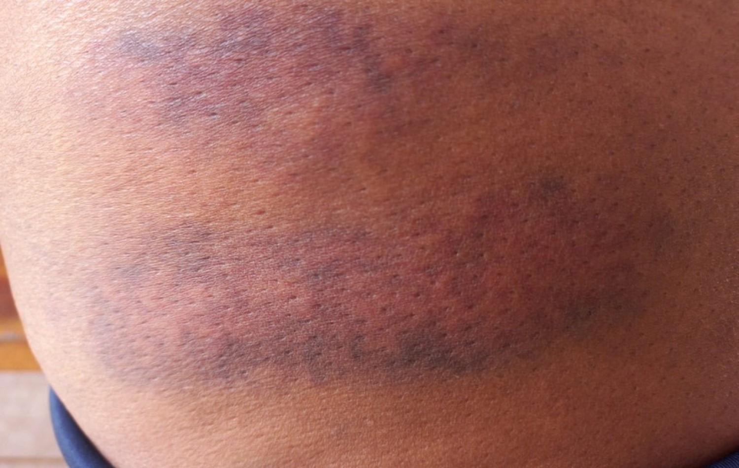 Passageira conta que foi golpeada com facão por motorista após ficar devendo R$ 8 da viagem: 'Impotência'