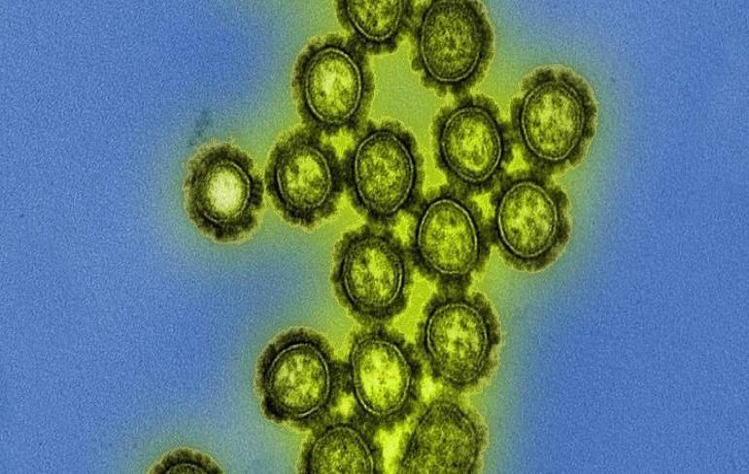 O que se sabe sobre o vírus influenza H3N2 que circula no Brasil