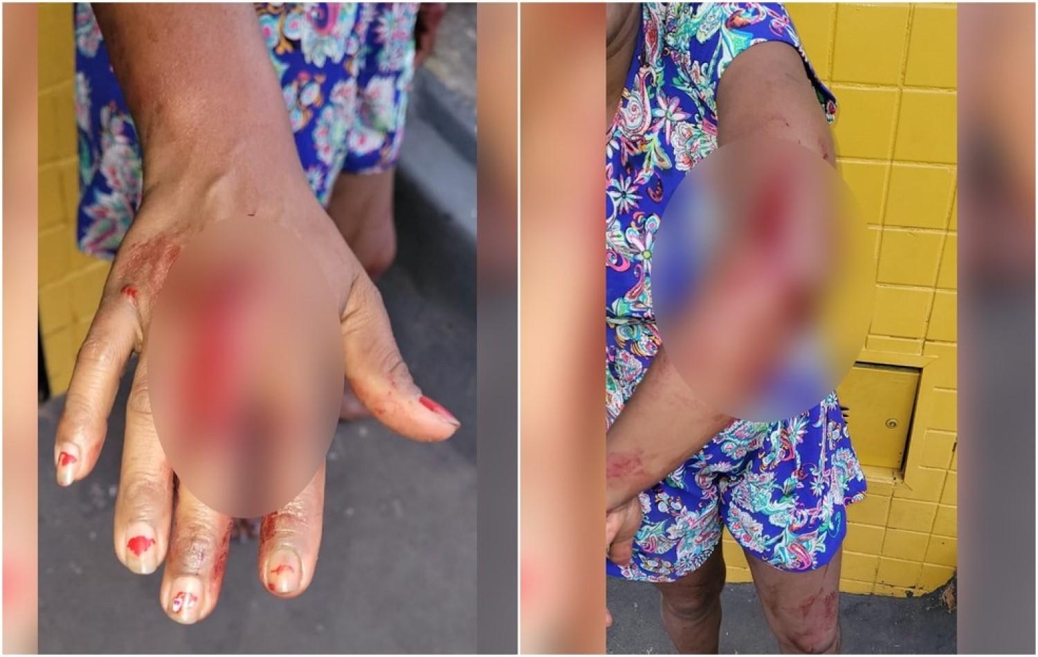 Mulher é presa suspeita de esfaquear outra por causa de chinelo, em Rio Verde