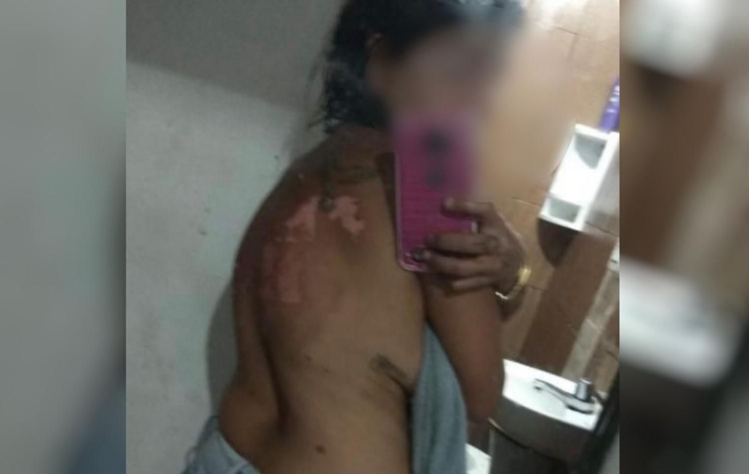 Jovem é preso suspeito de jogar óleo quente nas costas da companheira, em Santa Helena de Goiás
