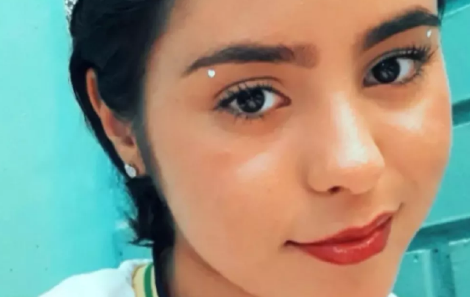 Pais relatam que filha está internada em estado grave na UTI após bater cabeça durante aula na escola