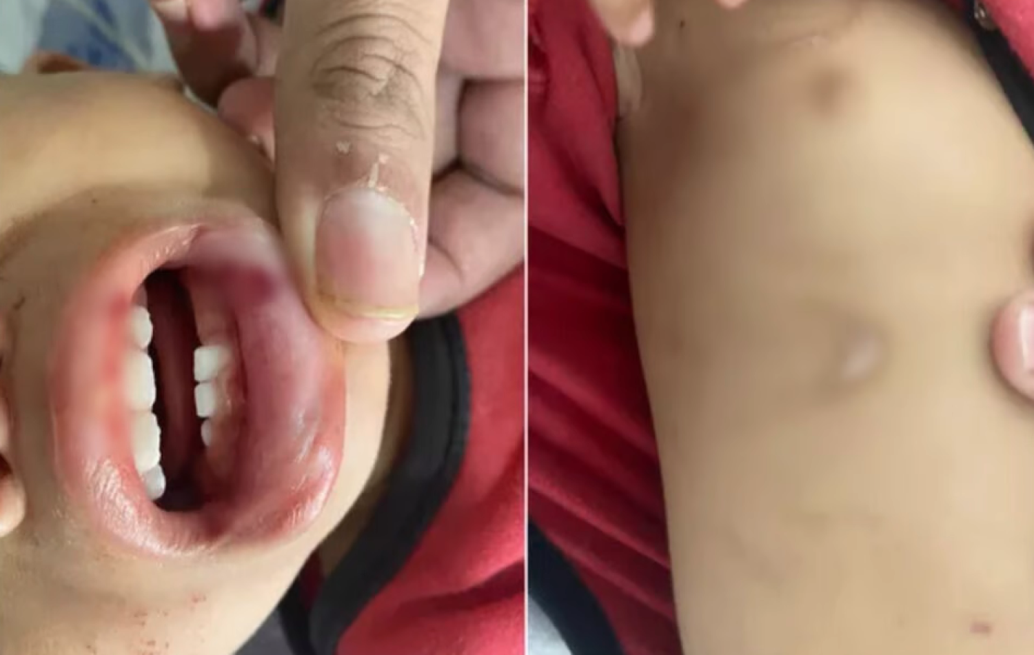 Tios são indiciados por tortura contra criança de 1 ano em Goianira