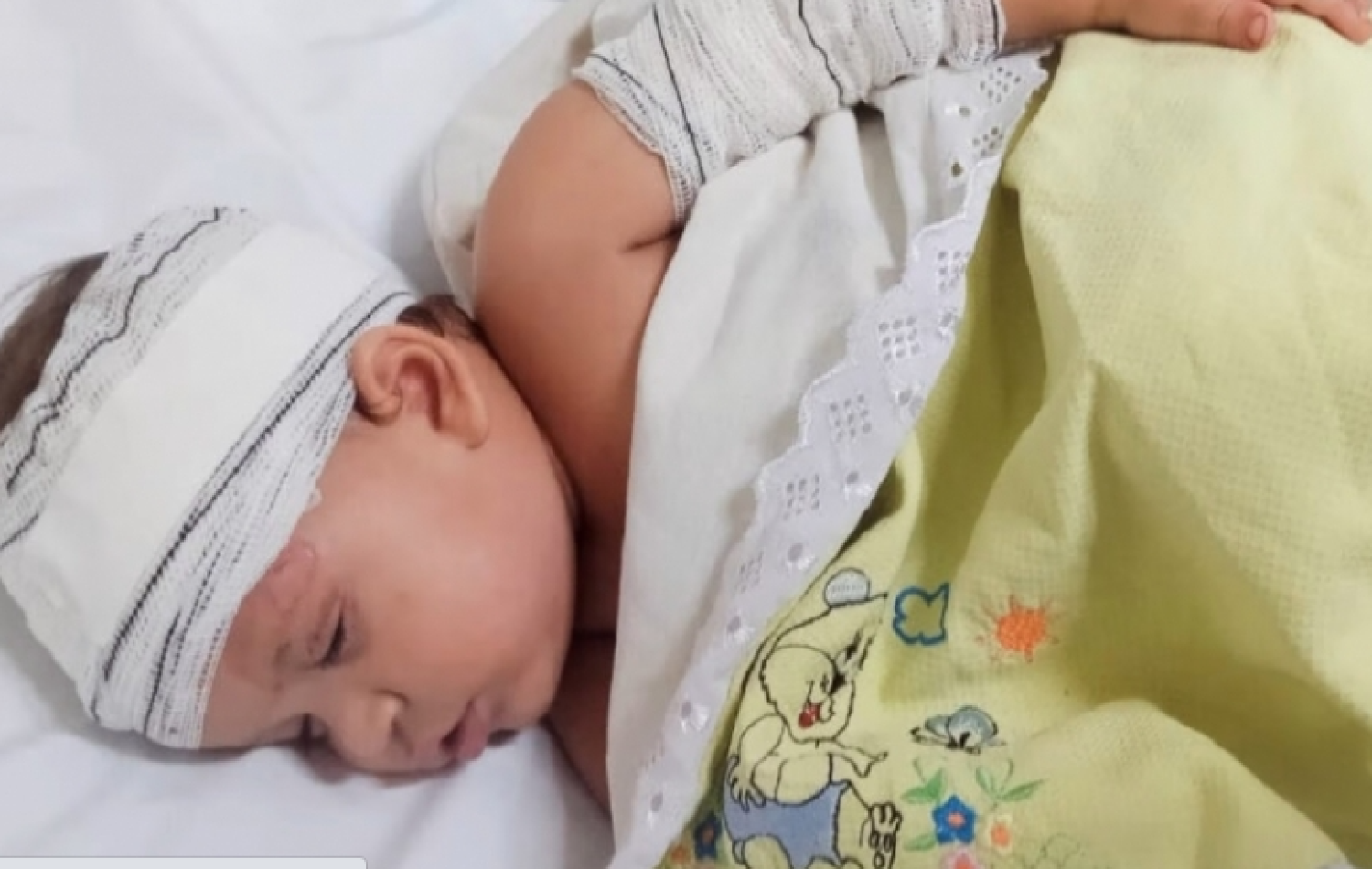 Casa pega fogo e bebê fica ferido após mãe tentar cozinhar com álcool, em Aparecida