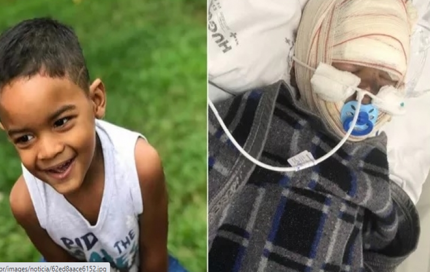 Criança é internada em UTI com queimaduras no corpo após bateria explodir dentro de carro, em Jataí