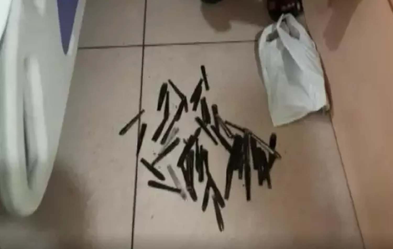 Médicos encontram 62 colheres no estômago de homem na Índia