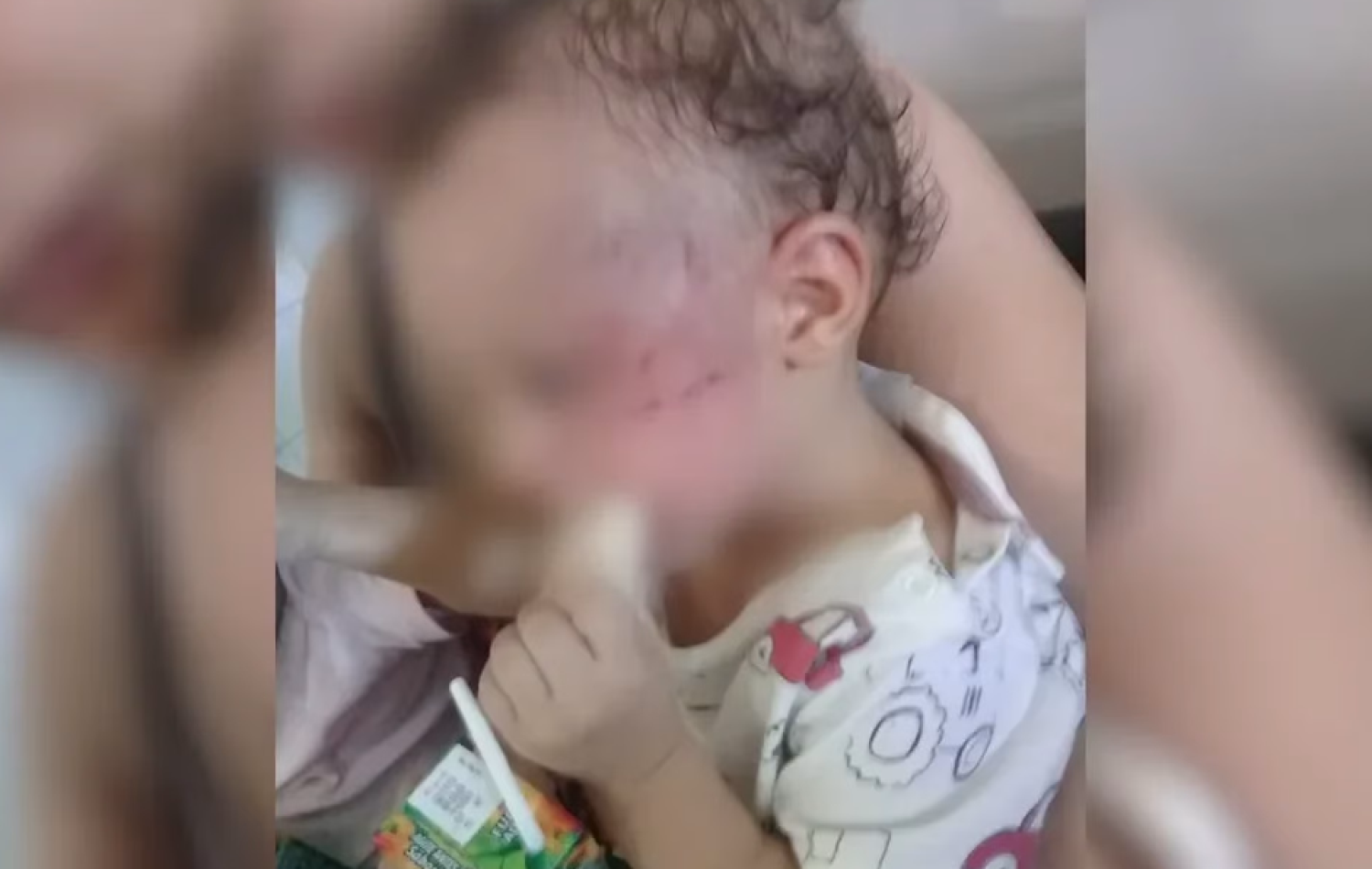 Pai é preso por espancar filho de 1 ano, em Goiânia