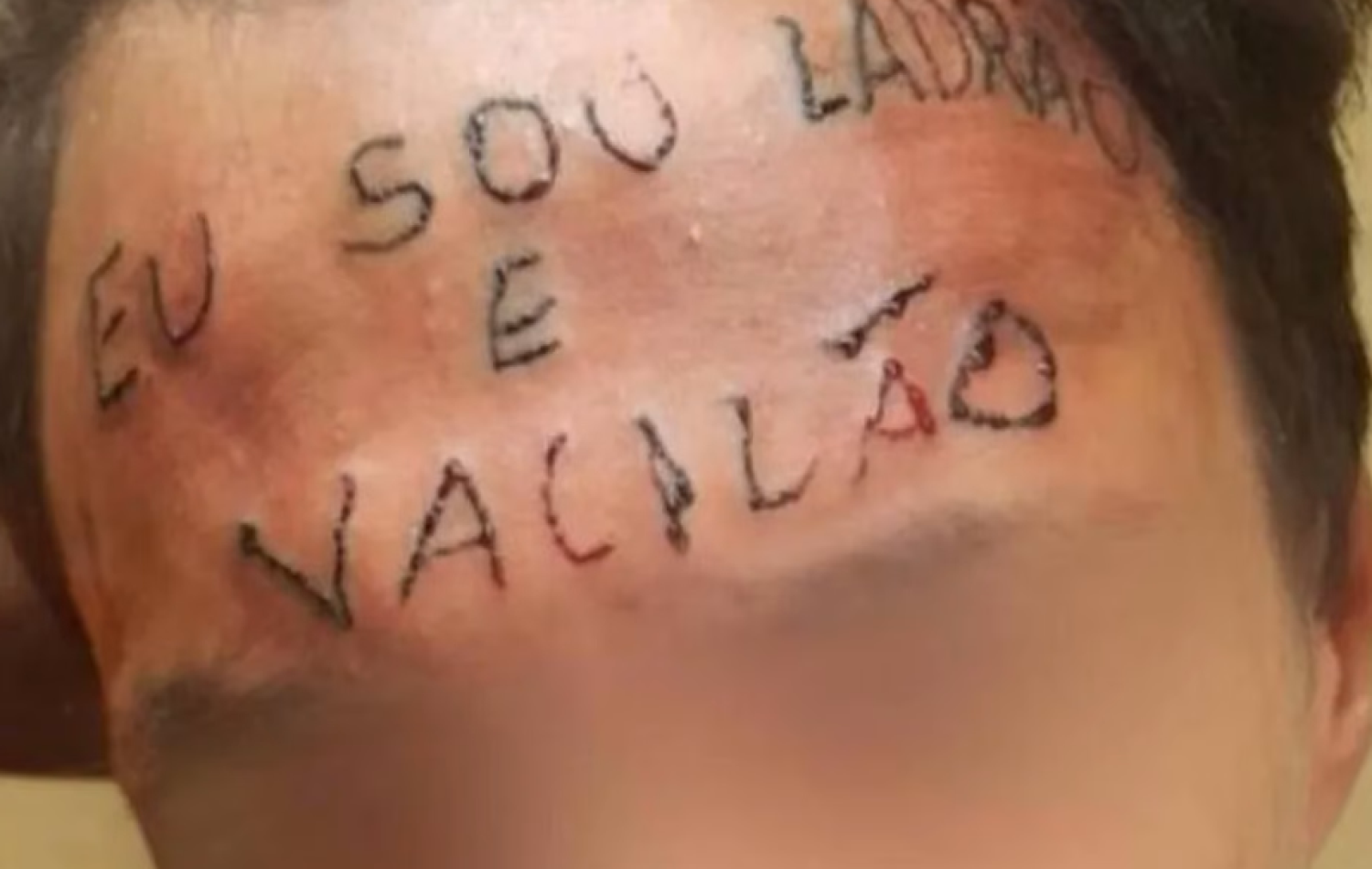 Homem que teve a testa tatuada com ‘sou ladrão e vacilão’ é preso em SP