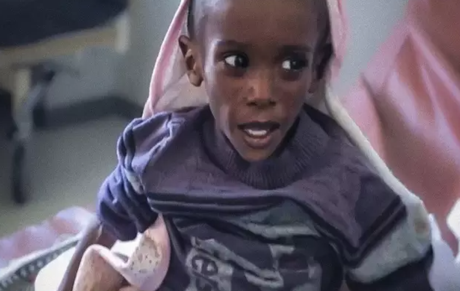 Fome na Etiópia: o menino chamado 'Rico' que pesa metade do que deveria