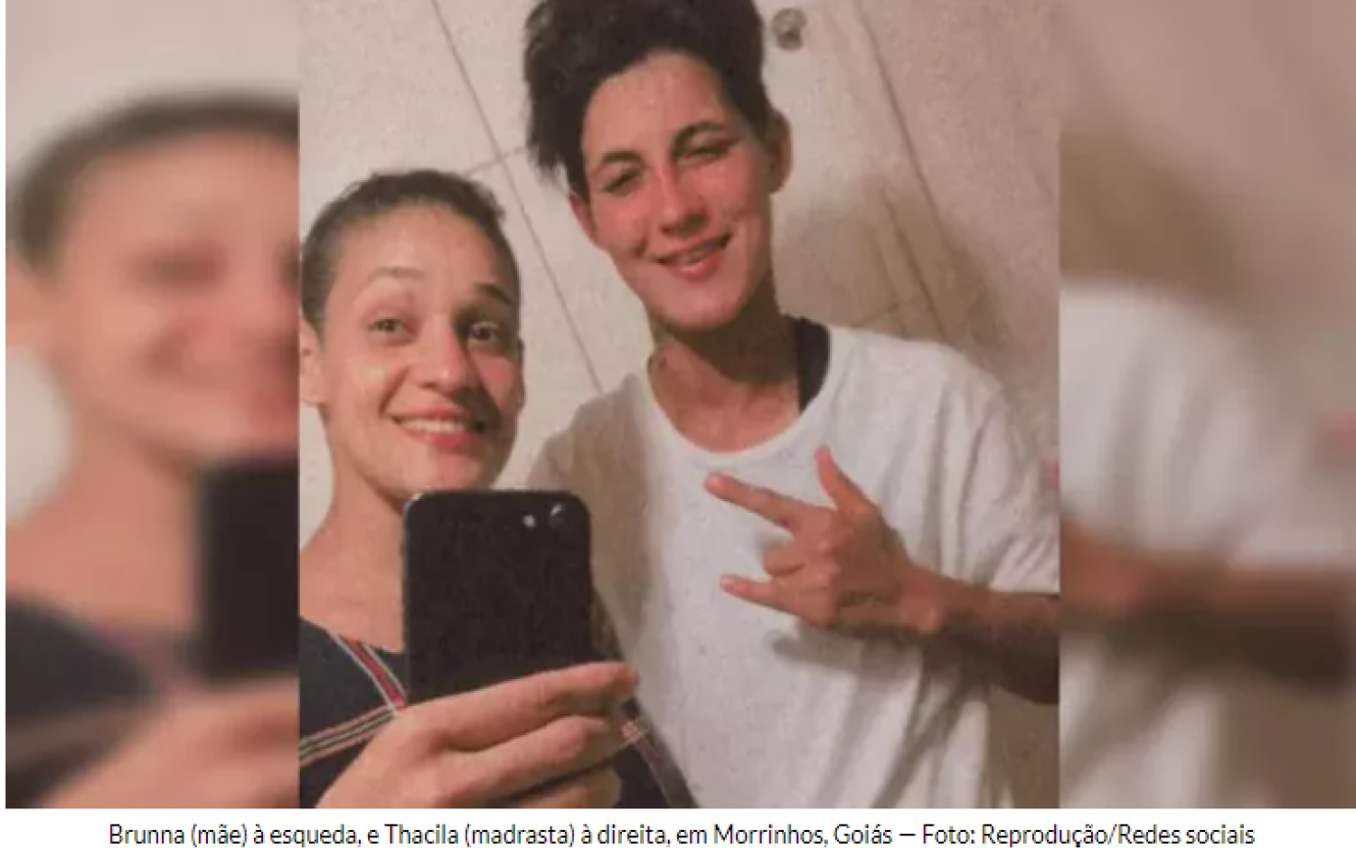 Criança é levada a hospital com o rosto desfigurado após ser queimada e espancada por mãe e madrasta em Goiás