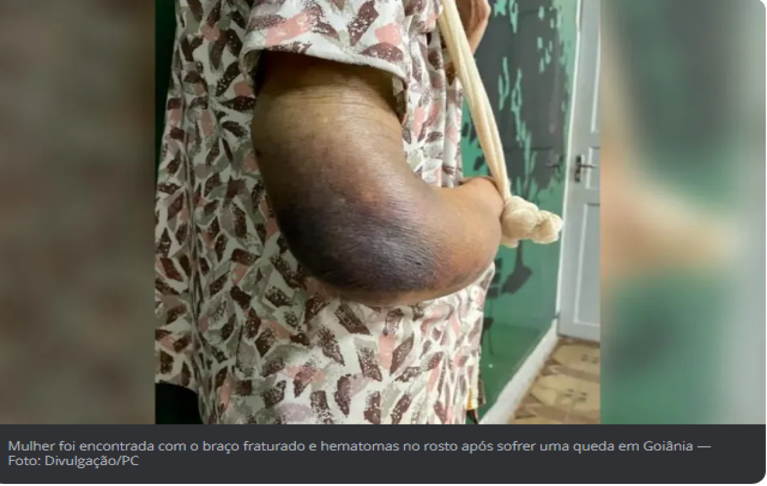 Filha é presa suspeita de explorar mãe idosa e não socorrê-la após vítima quebrar o braço em queda em apartamento