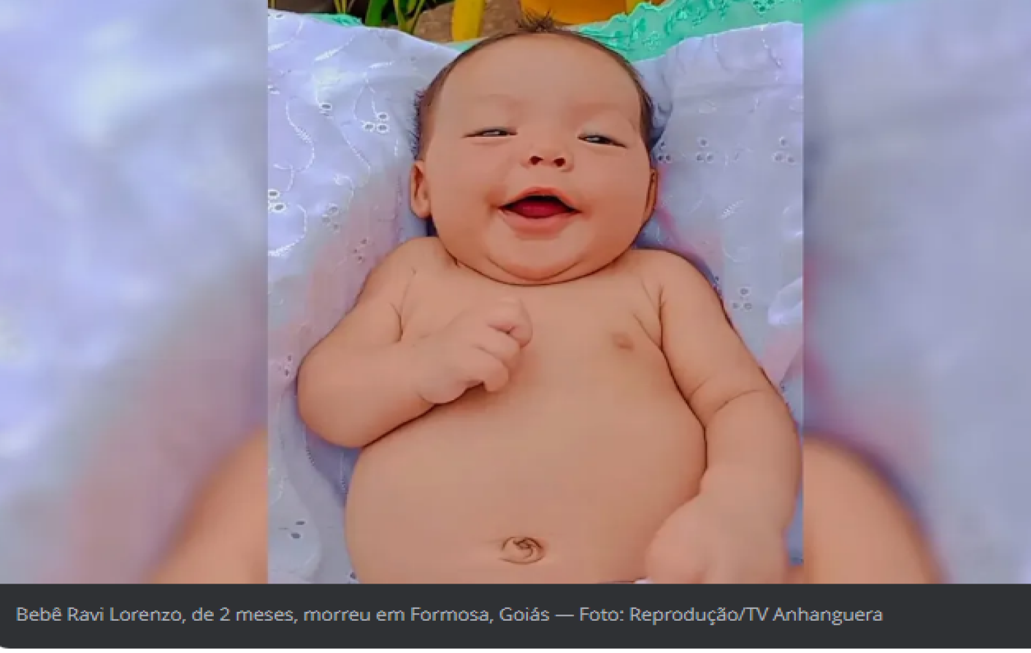 Morte de bebê que ingeriu colírio por engano não tem relação com a substância e foi causada por pneumonia, diz polícia