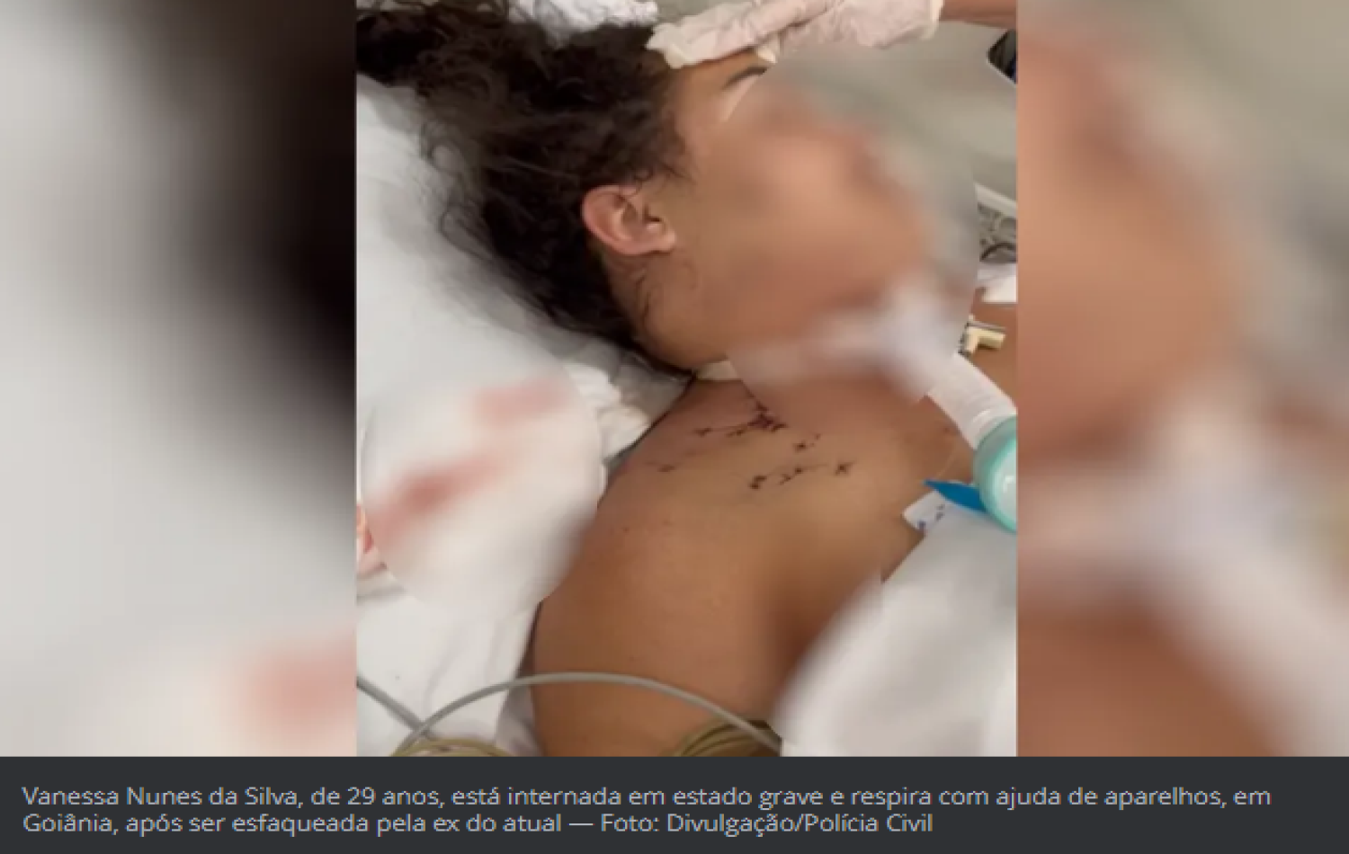 Mulher esfaqueada com 20 facadas por ex do atual estava grávida e perdeu o bebê após ataque, diz delegado
