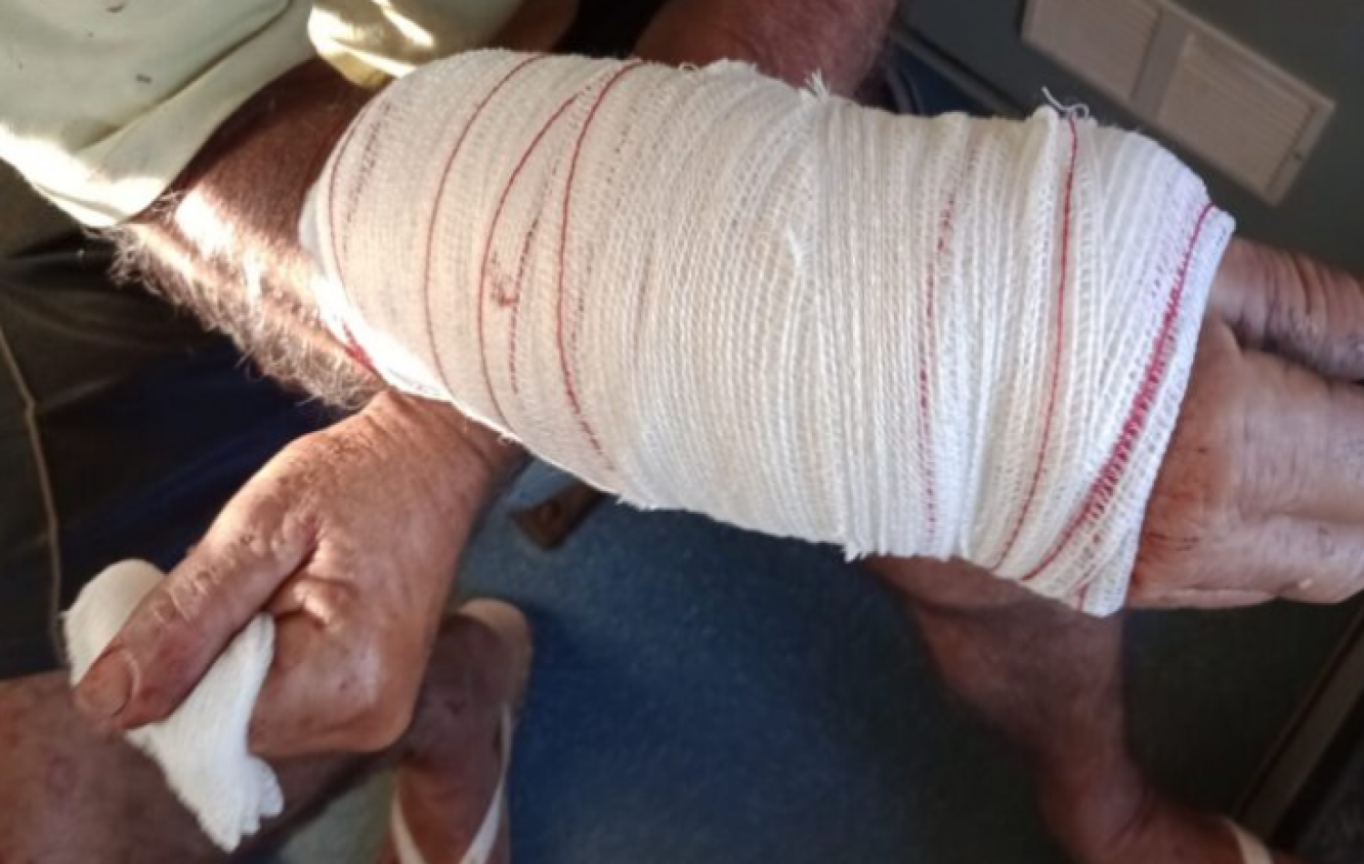 Pitbull ataca ciclista que ficou com braço dilacerado em Chapadão do Sul.
