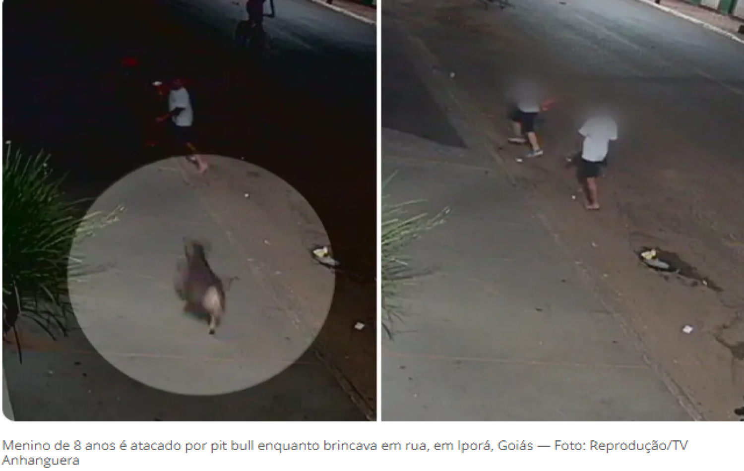 Menino de 8 anos é atacado por pit bull enquanto brincava em rua