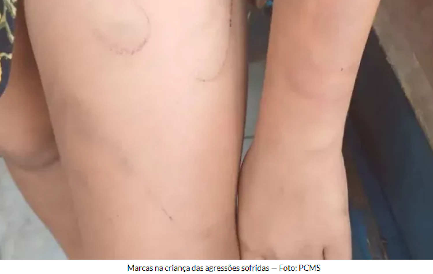 Homem é preso por agredir e torturar enteada autista de 11 anos em MS