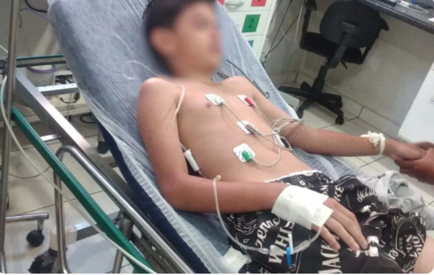 Menino que comeu lagartixa ficou traumatizado e deve começar tratamento após crises de ansiedade, diz mãe