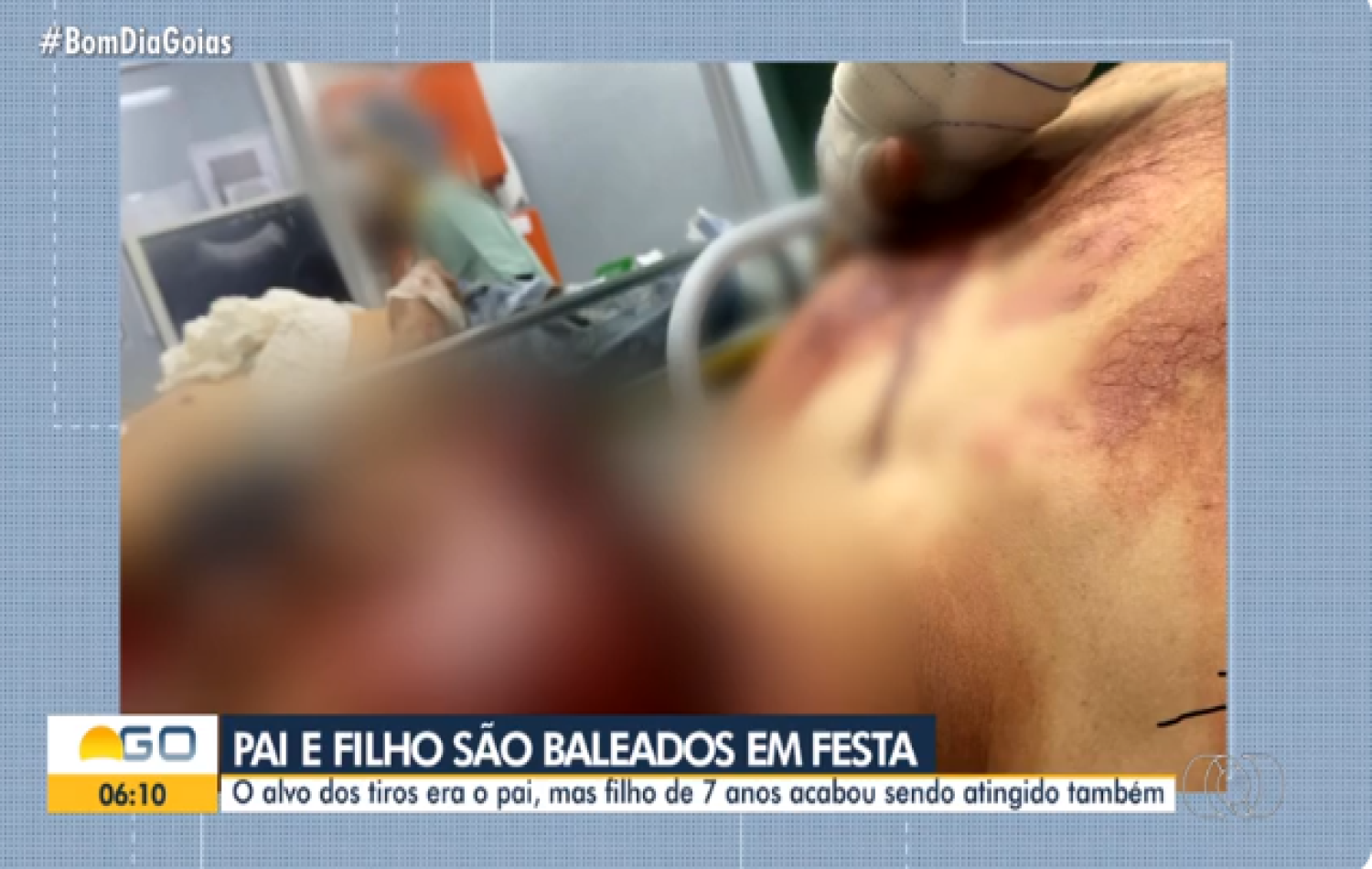 Pai e filho de 7 anos são baleados dentro de casa em Goiânia