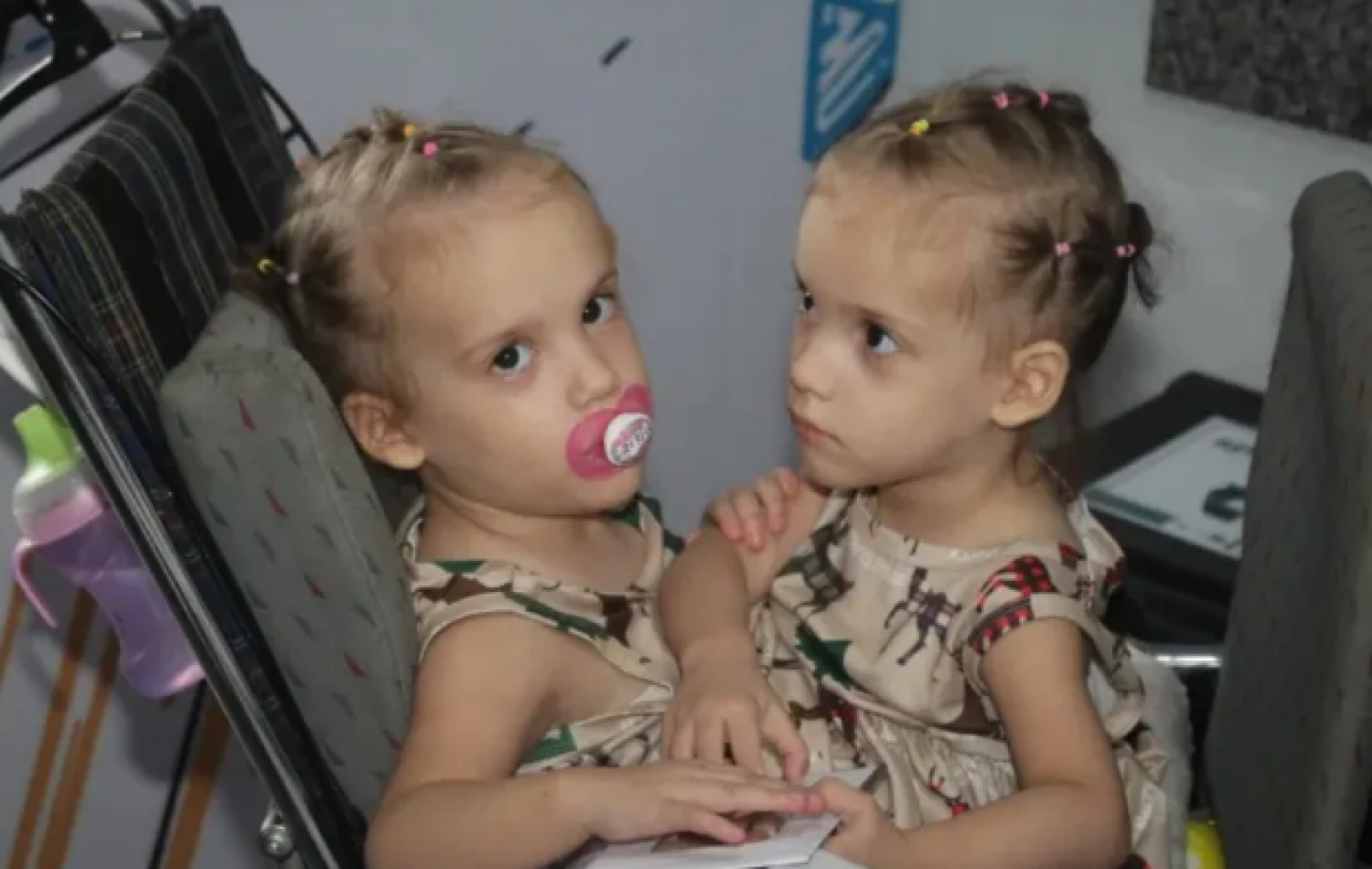 Gêmeas Heloá e Valentina vão à escola pela primeira vez um ano após cirurgia de separação