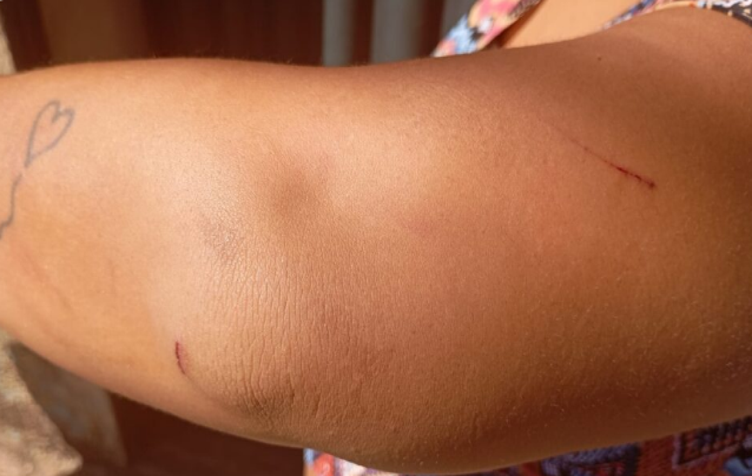 Criança de 9 anos vai até UPA pedir socorro para mãe agredida pelo padrasto, em Senador Canedo
