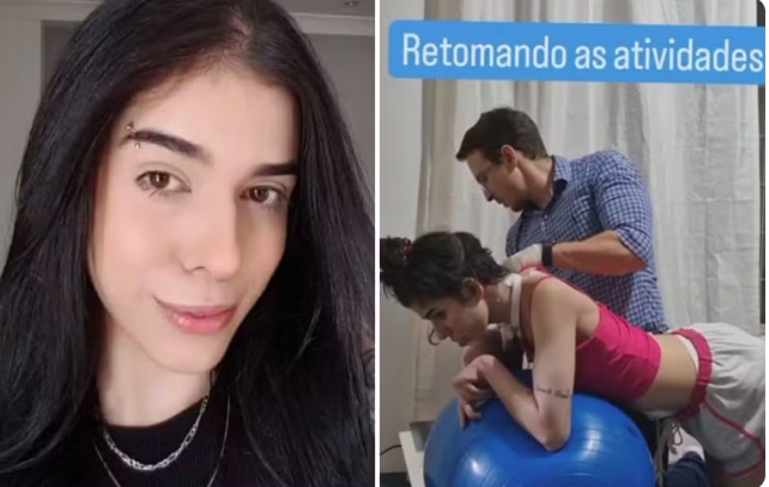 Jovem que teve grave reação alérgica após cheirar pimenta impressiona internautas com vídeo em sessão de fisioterapia