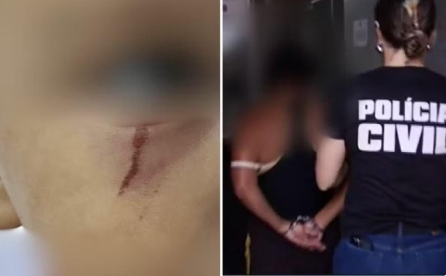 Irmão de criança de 3 anos espancada pela mãe por perder escova de cabelo também foi ferido durante agressão, diz delega