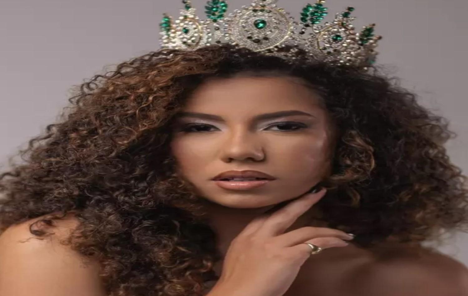 Larissa Costa vai representar Costa Rica e MS no Concurso Miss Supranational Brasil 2025