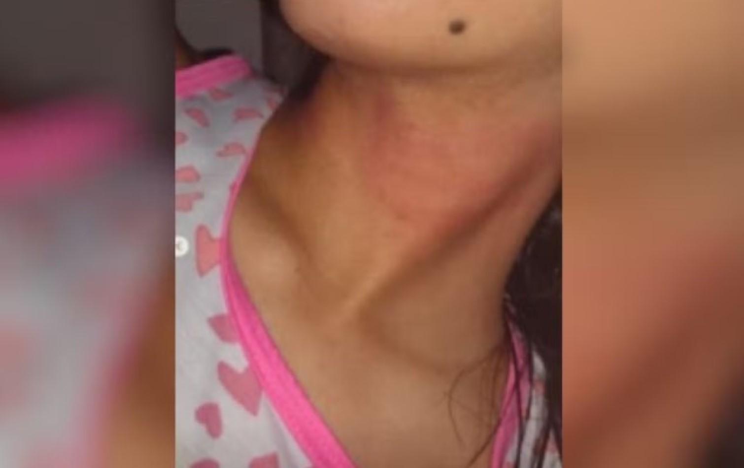 Pai é preso por esganar e bater a cabeça da filha de 17 anos na parede após jovem chegar tarde em casa, diz polícia
