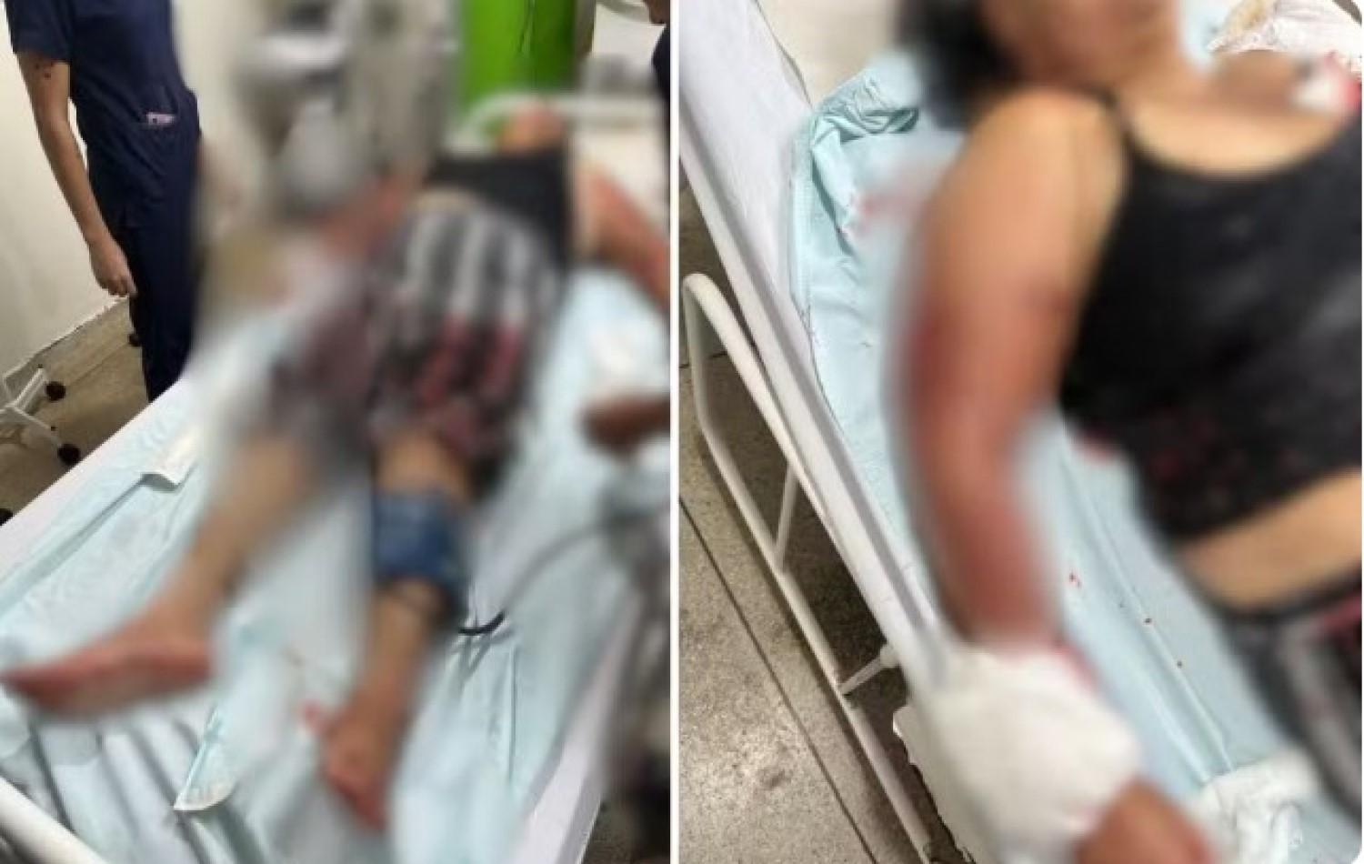 Avó atacada por pit bull isolou neta bebê em quarto e precisou trancar porta da casa para se livrar de mordidas do cão,