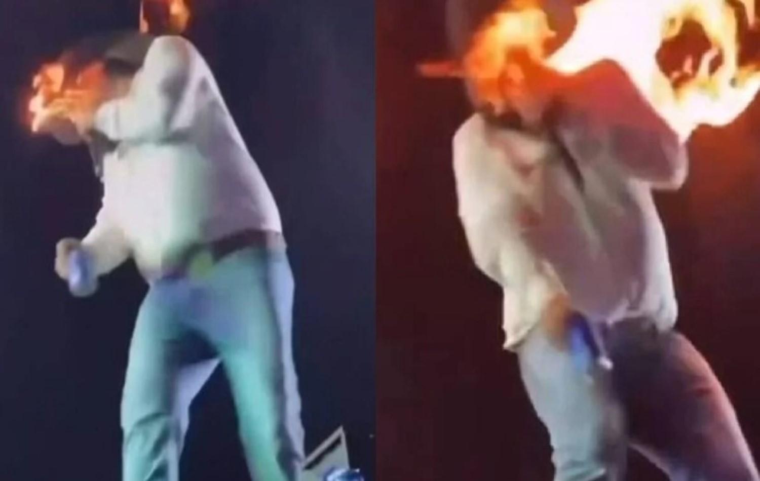 Cantor sertanejo fica ferido após ter rosto atingido por fogo durante show