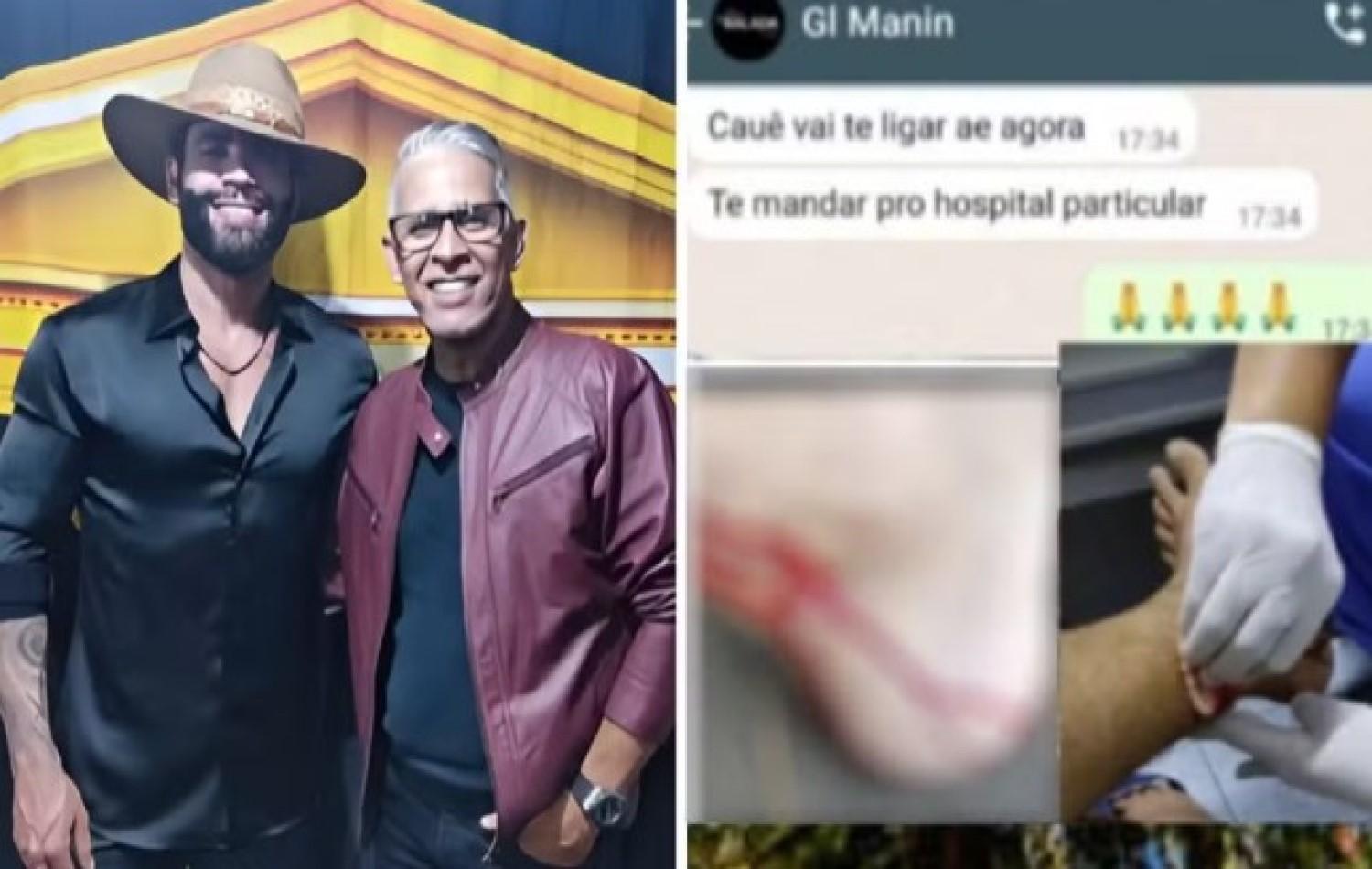Irmão de Gusttavo Lima conta que foi mordido e derrubado por macaco enquanto passeava em parque, em Goiânia