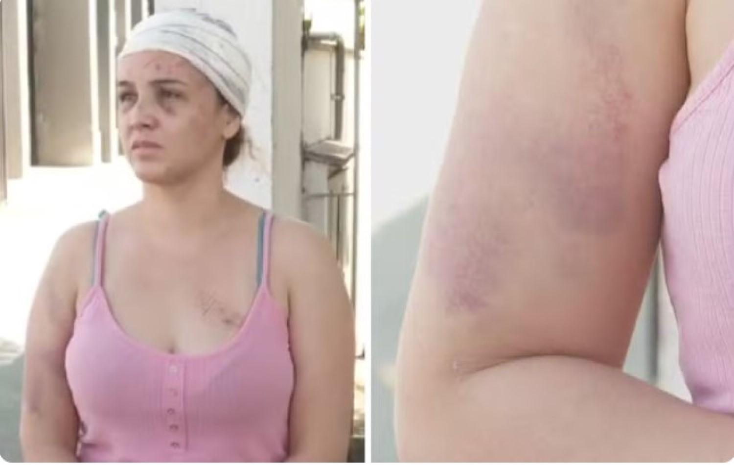 Cantora que denuncia ter sido espancada por parceiro de dupla diz que levou soco na frente dos filhos