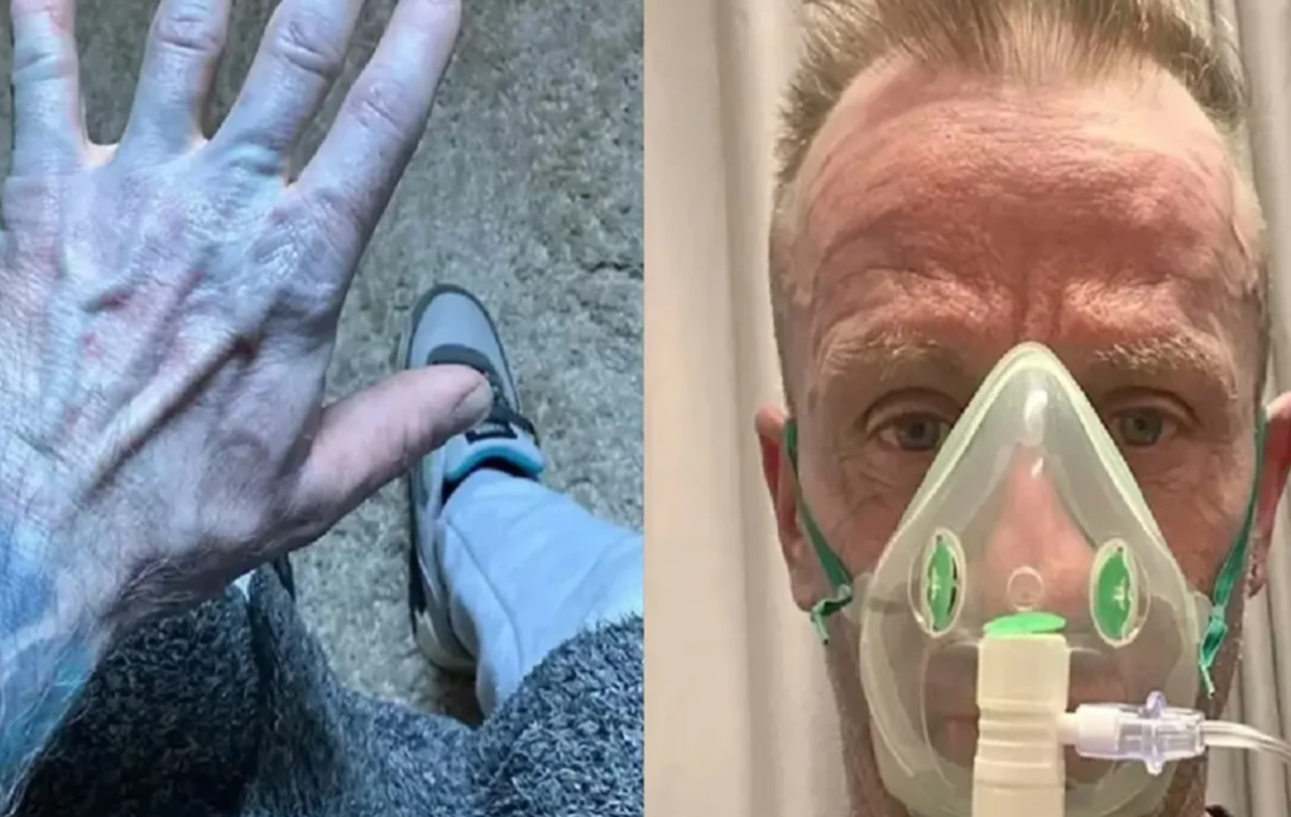 Homem acorda com o corpo azul, corre para o hospital e se choca com diagnóstico